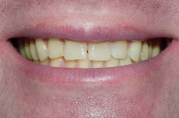 Dental before and after photos